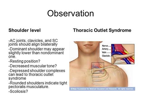 jack's compression test|positive shoulder depression test.